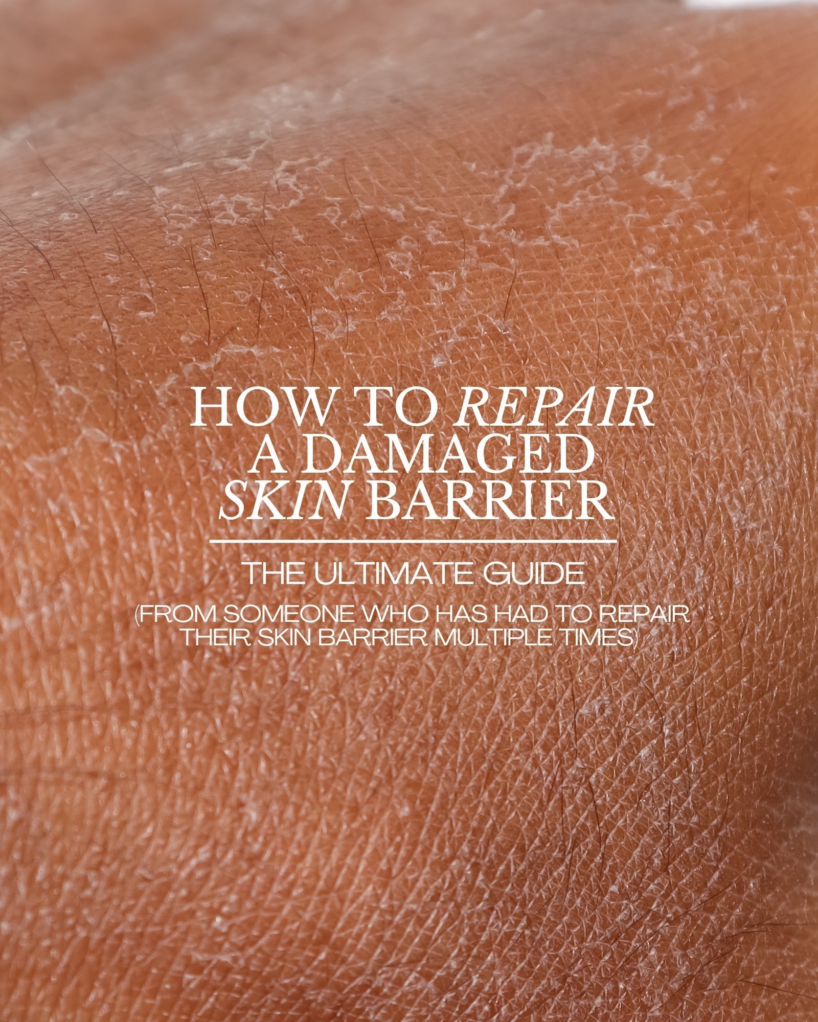 Skin Burns After Skincare? It May Be a Damaged Skin Barrier
