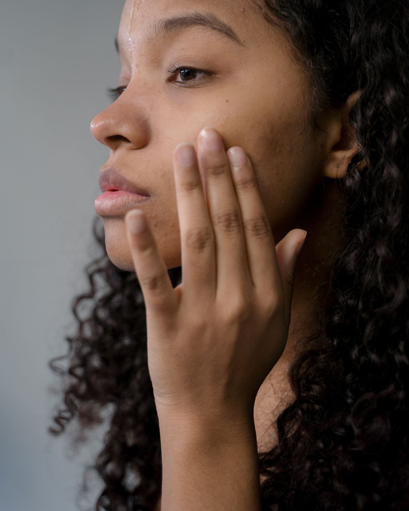 What years of dealing with acne has taught me