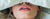 Lip Care