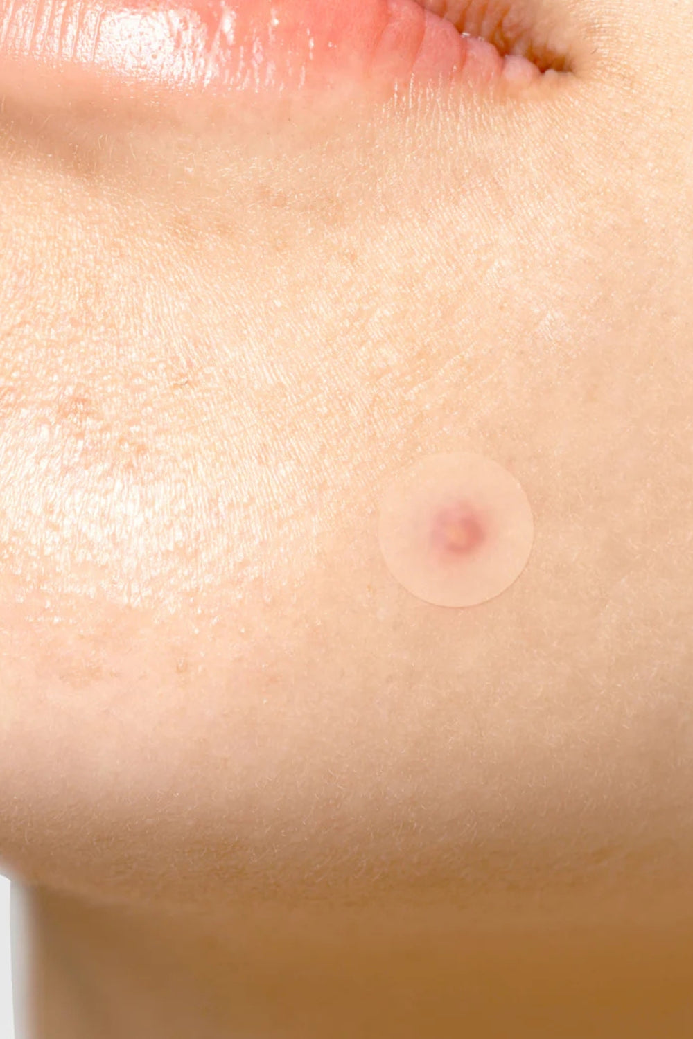 TIA'M - Surprise H Patch - 1pc (18 patches)